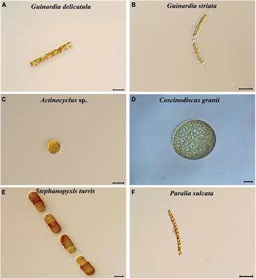 Evolutionary dynamics of plastomes in coscinodiscophycean diatoms revealed by comparative genomics